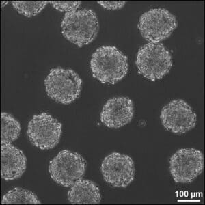 Phase image of Embryoid Bodies (type of cellular spheroid) in suspension culture. Individual EBs are composed of approximately 1000 mESCs. Scale bar = 100 µm.