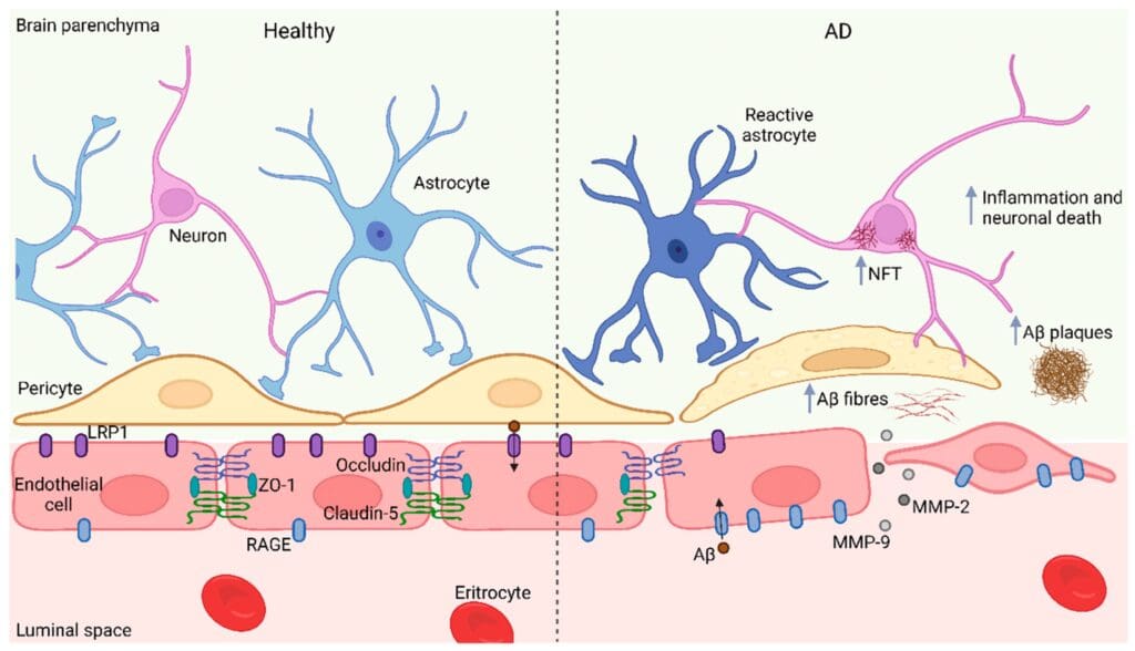 Schematic diagram showing Alzheimer's disease affects on the blood-brain barrier: increased permeability, amyloid-beta buildup, inflammation, tau aggregation, and neuronal death.