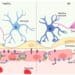 Schematic diagram showing Alzheimer's disease affects on the blood-brain barrier: increased permeability, amyloid-beta buildup, inflammation, tau aggregation, and neuronal death.